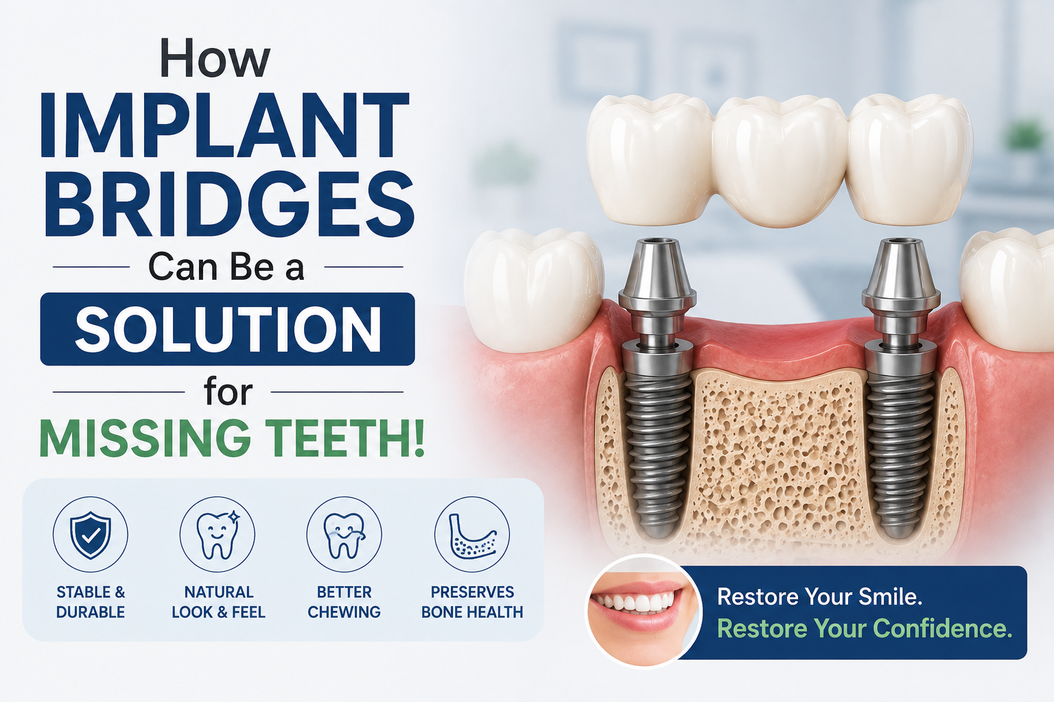 How Implant Bridges Can Be a Solution for Missing Teeth!