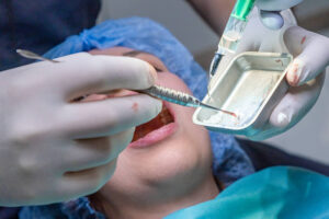 How Can Bone Grafts and LPRF Help with Dental Implants?