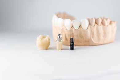 dentist implants